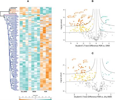 Proteomics profiling of vitreous humor reveals complement and coagulation components, adhesion factors, and neurodegeneration markers as discriminatory biomarkers of vitreoretinal eye diseases